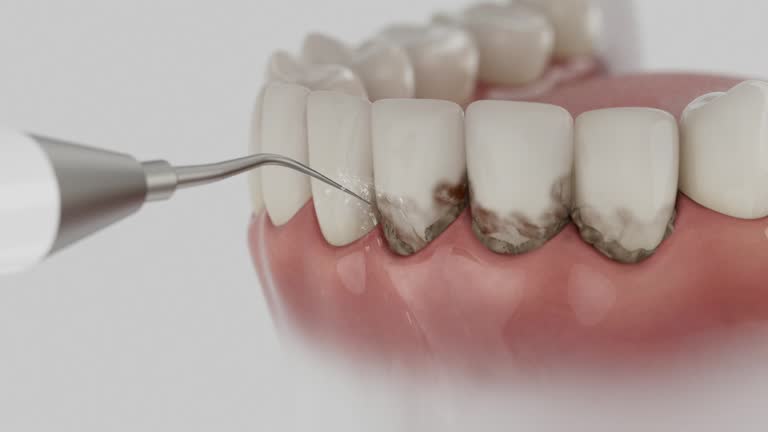 Reliable Invisalign Clear Aligners contractor in Kosciusko, MS by Smile Center Dentistry